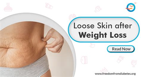 How To Tighten Loose Skin After Weight Loss Effective Tips And Solutions Freedom From Diabetes