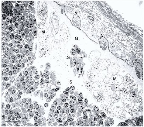 Tem Of Sarcocyst Walls Of Sarcocystis Sp In Sarcocyst No 3 Note Download Scientific Diagram