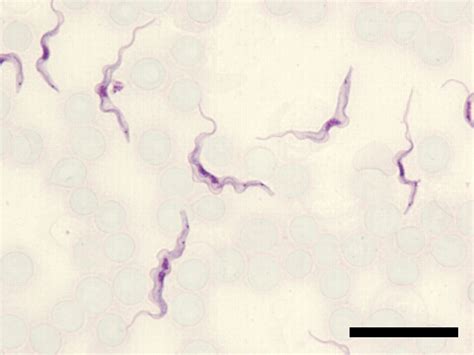 Trypanosoma Brucei Rhodesiensespecimen Slides Nekken Brc Nekken