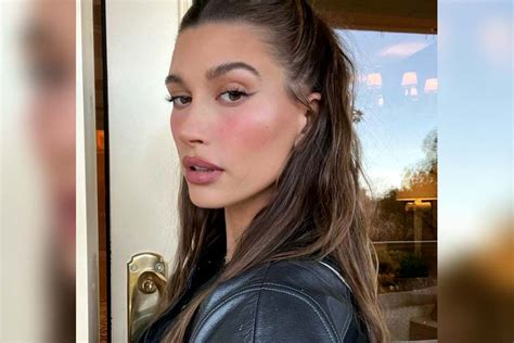 Hailey Bieber Abre O Jogo E Fala Pela Primeira Vez Sobre O Seu Problema