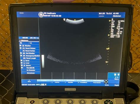 Ge Logiq E Ultrasound Machine For Sale