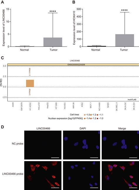 Tumor Promoting Activity Of Long Noncoding RNA LINC00466 In Lung