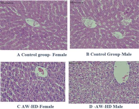 Aandb Liver 40x H E Stain Liver Showing Normal Hepatocellular