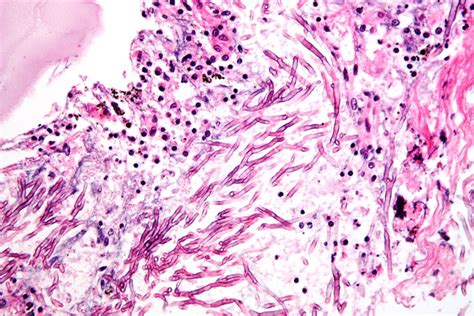 Detección de Legionella Biomaro Laboratorio Madrid Aluche