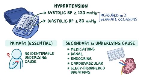 Approach To Hypertension Clinical Sciences Osmosis Video Library