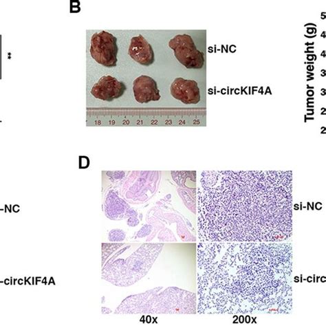 Knockdown Of Circkif4a Inhibits Ovarian Cancer Growth And Metastasis In