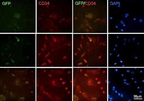 Different Expression Patterns Of Cd In Gfp Positive Bone Marrow Cells