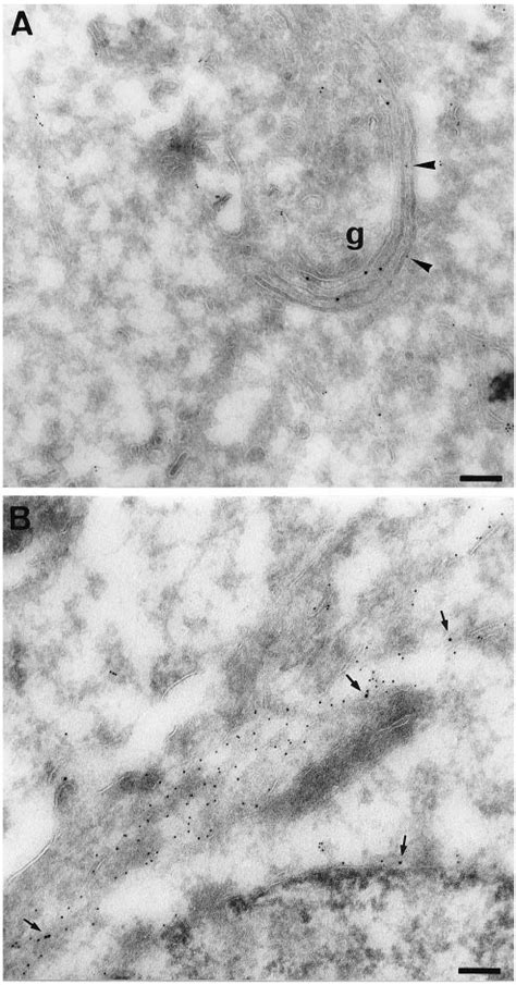 Colocalization Of Gal T And Ii In Rab Q L Transfected Cells Hela