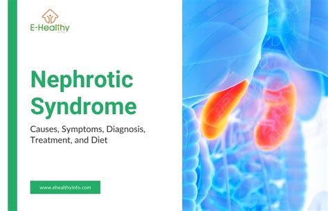 Nephrotic Syndrome: Causes, Symptoms, And Treatment Options