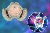 Prodromal Parkinson's Disease | Frontiers Research Topic