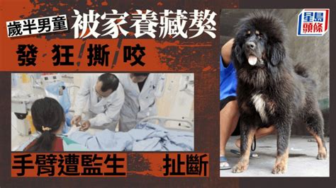 家有惡犬︱江西藏獒發狂咬少主 歲半男童手臂遭監生扯斷 星島日報