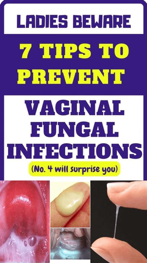 This Way You Will Prevent Vaginal Fungal Infections Rmedicaldaily