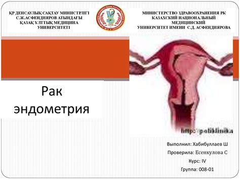 Рак эндометрия - online presentation