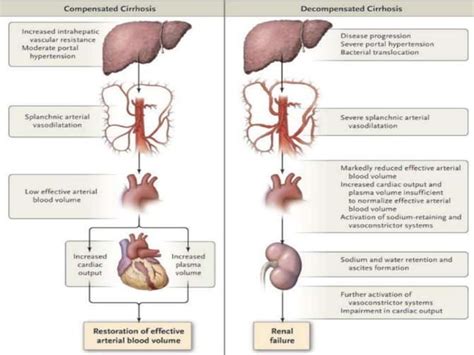 Hepatorenal Syndrome Ppt