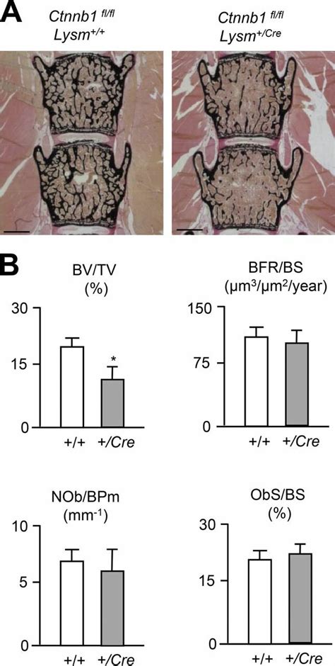 Phenotypic Analysis Of Ctnnb1fl Fl LysM Cre Mice A Von Kossa Van