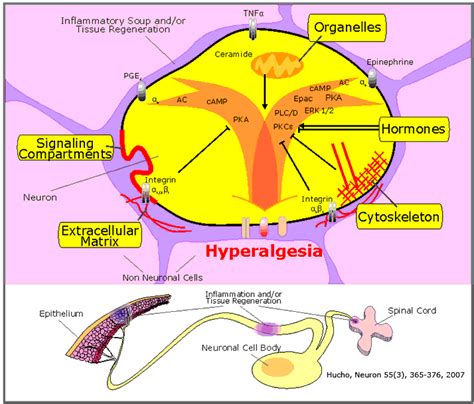 hyperalgesia – Dr Rajiv Desai