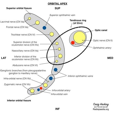 Superior orbital fissure (mnemonic) | Radiology Reference Article ...