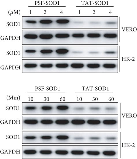 PSF-SOD1 increases intracellular total SOD enzyme activity. VERO and... | Download Scientific ...