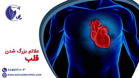 علائم بزرگ شدن قلب