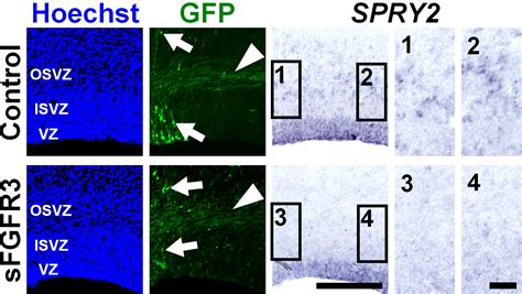 Figures And Data In Gyrification Of The Cerebral Cortex Requires Fgf