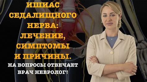 ИШИАС СЕДАЛИЩНОГО НЕРВА: ЛЕЧЕНИЕ, СИМПТОМЫ И ПРИЧИНЫ. | Ишиас, Здоровье ...