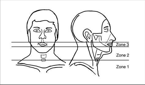 Initial Management Of Blunt And Penetrating Neck Trauma Bja Education