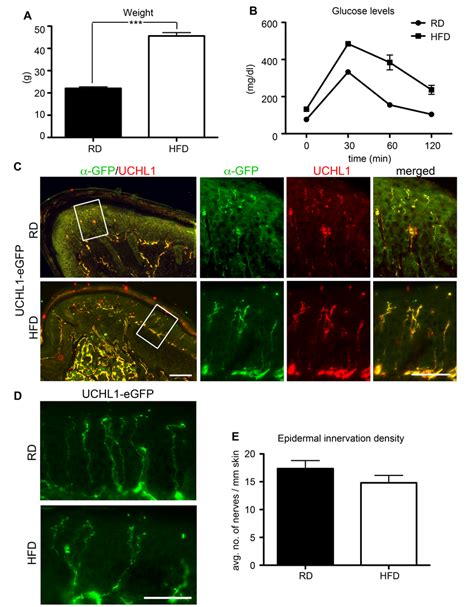 UCHL1 EGFP Reporter Mice Reveal Epidermal Innervation Density In