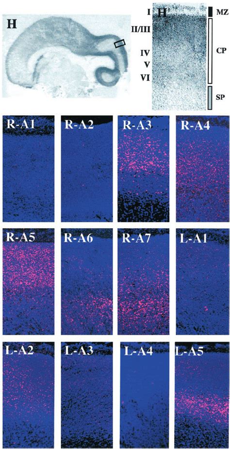 Laminar And Zone Specific Patterns Of Epha And Ephrin A Gene