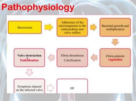 Infective Endocarditis