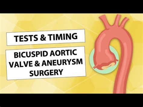 Surgeon Q A Tests Timing Bicuspid Aortic Valve Aneurysm Surgery