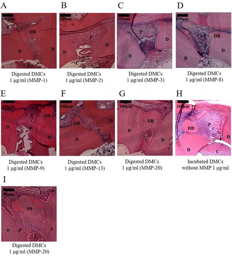 Histological Images Of Tertiary Dentin Formation Days After