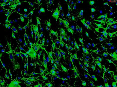 Human Endometrial Microvascular Endothelial Cells HEMEC