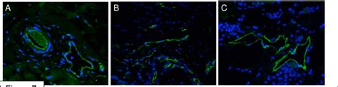 Expression Of Blood And Lymphatic Endothelial Cell Markers In