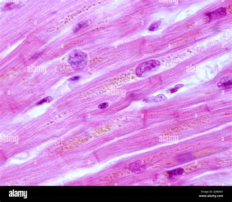 Lipofuscin In Heart Muscle Cells Light Micrograph Stock Photo Alamy