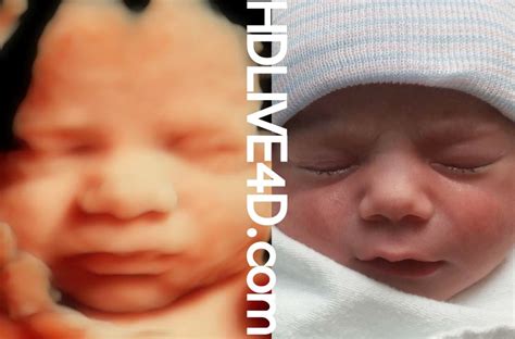 D Hdlive Ultrasound Gallery D D Hd Ultrasound Virginia