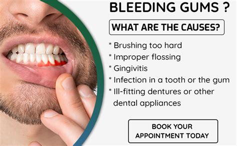 Gum Disease: Symptoms, Causes and Treatments – Adsorthodontics