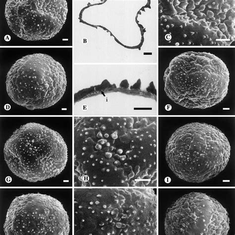 A C F Sem Pollen Micrographs B Tem Micrographs A C Ripogonum Download Scientific Diagram