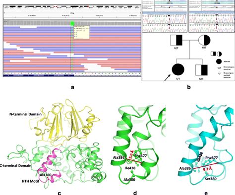 A Integrative Genomics Viewer Igv Profile Showing Homozygous