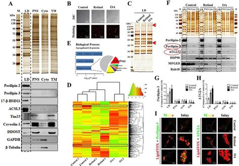 Proteomic Analysis Reveals Differentially Expressed Lipid Droplet Ld