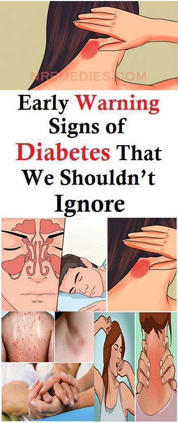 Early Warning Signs Of Diabetes That We Shouldnt Ignore Health Diy Blog