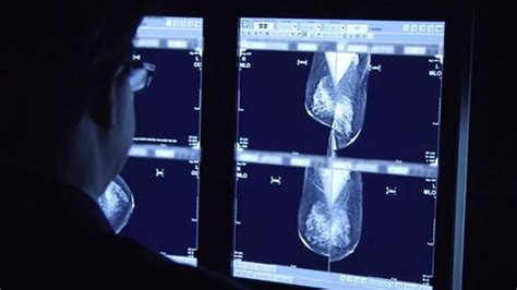 3d Mammogram Technology Better For Women With Dense Breasts