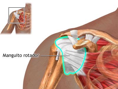 Problemas En El Hombro Lesiones Del Manguito Rotador Centro