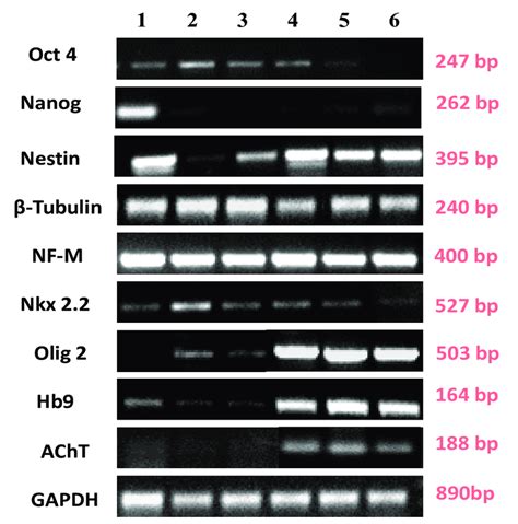 Rt Pcr Analysis Showing Expression Of Various Markers At Genetic Level