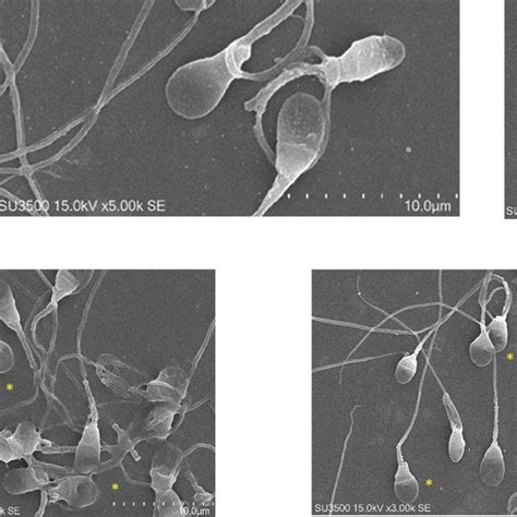 Evaluation Of Sperm Morphology Using The Scanning Electron Microscope Download Scientific