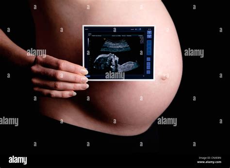 A Pregnant Woman Holding An Ultrasound In Front Of Her Naked Belly Stock Photo Alamy