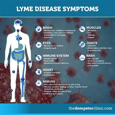 Lyme Disease 101 49 Off