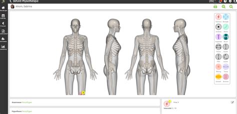 Bodychart Interaktive Befundung Von Synaptos Neu Gedacht