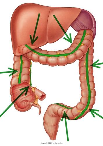 Conversion Of Taeniae Coli