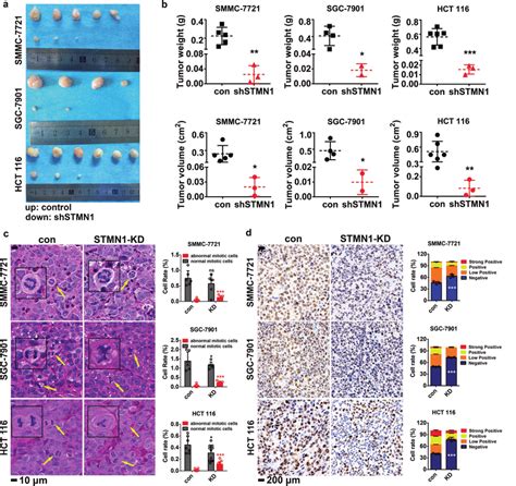 STMN1 Affects Tumorigenesis In Vivo The Hepatocellular Carcinoma Cell