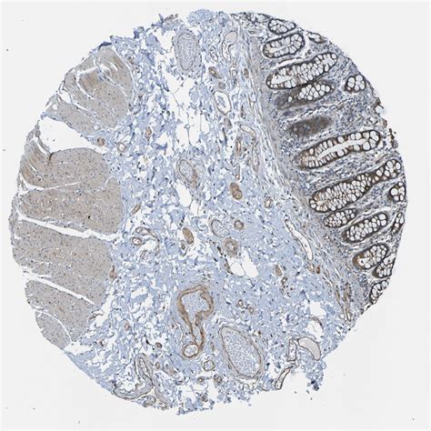 Tissue Expression Of Lgr Staining In Colon The Human Protein Atlas